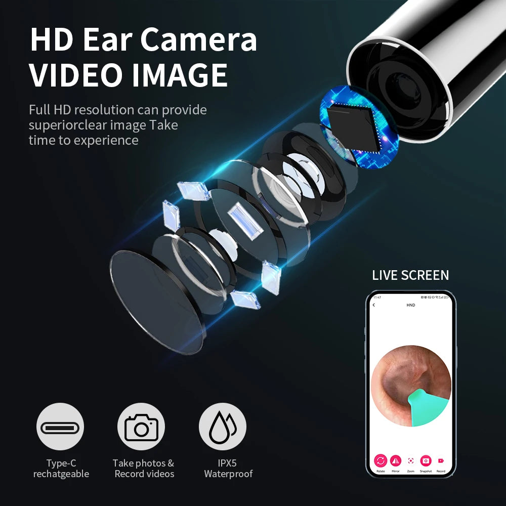 ClearSight HD Smart Visual Ear Cleaner – 1080P Otoscope with Wax Removal Kit
